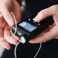 Closeup shot of a woman's hands holding a closed loop insulin pump.